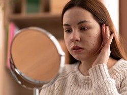 BPOM Umumkan Daftar Baru Skincare Berbahaya, Bisa Bikin Kulit Makin Gelap