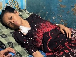 Kisah Ibu Siti Sholeha Pasien Gagal Ginjal, Berjuang Sembuh Demi Keluarga