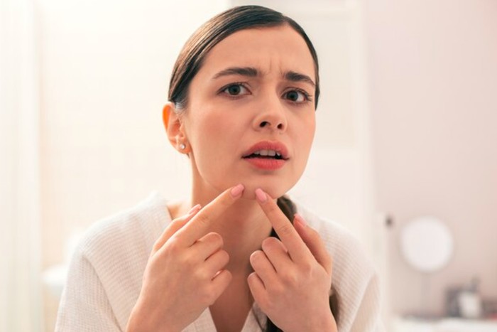 Menyentuh atau menggosok kulit terlalu banyak dan terus-menerus mencoba produk perawatan kulit baru dapat memperburuk jerawat. Tangan kita membawa berbagai bakteri dan kotoran yang dapat dengan mudah ditransfer ke wajah.