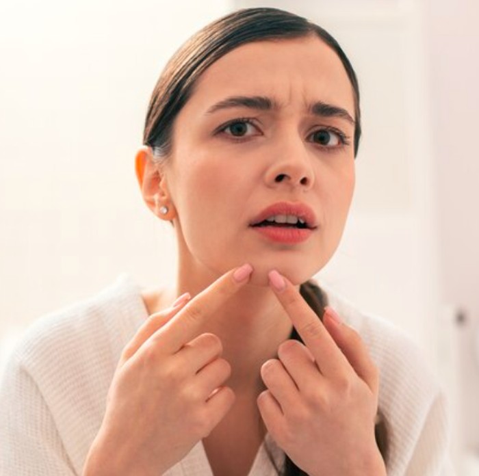 Menyentuh atau menggosok kulit terlalu banyak dan terus-menerus mencoba produk perawatan kulit baru dapat memperburuk jerawat. Tangan kita membawa berbagai bakteri dan kotoran yang dapat dengan mudah ditransfer ke wajah.
