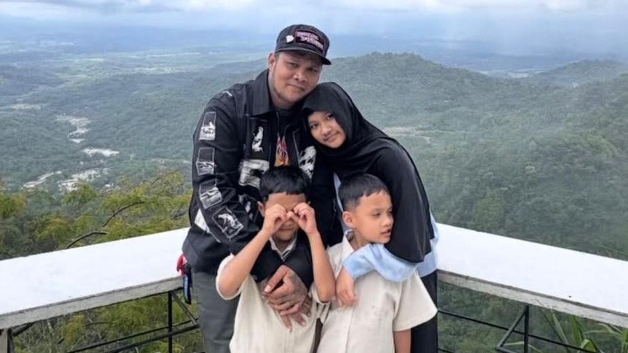 Penampilan Terbaru Starla usai Hilangkan Tanda Lahir