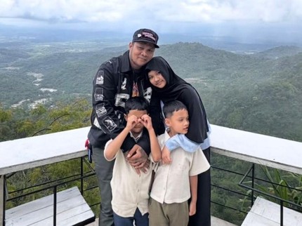 Penampilan Terbaru Starla usai Hilangkan Tanda Lahir, Intip Potretnya