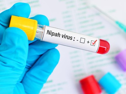 10 Gejala Virus Nipah, Penyakit Zoonosis Mematikan Tanpa Vaksin yang Merebak di Negara Tetangga RI
