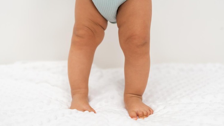 Mengenal Kaki O dan X pada Anak&colon; Perbedaan&comma; Diagnosis&comma; hingga Penanganan