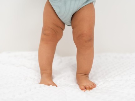 Mengenal Kaki O dan X pada Anak: Perbedaan, Diagnosis, hingga Penanganan