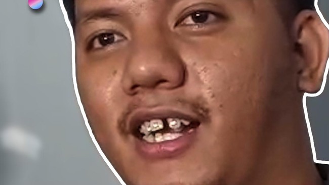 Video: 3 Bulan Direhab, Kondisi Psikologis Onadio Leonardo Lebih Stabil