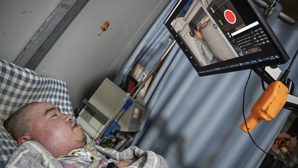 FOTO: Lumpuh Total, Pria China Operasikan Smart Farming dengan 1 Jari