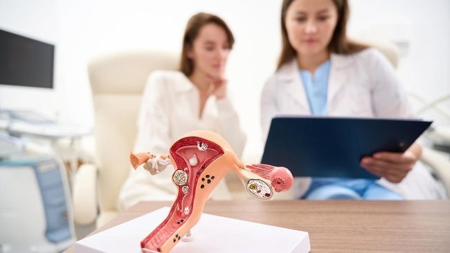 9 Obat Rumahan untuk Mengatasi Mioma atau Fibroid Rahim