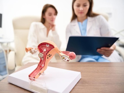 9 Obat Rumahan untuk Mengatasi Mioma atau Fibroid Rahim