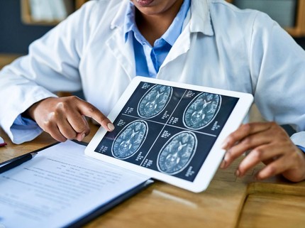 Tes Ketajaman Otak 5 Menit: Seberapa Besar Pengaruh Kebiasaan Sehari-hari?