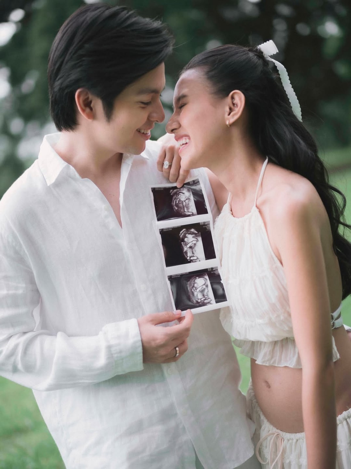 Angga Yunanda dan Shenina Cinnamon