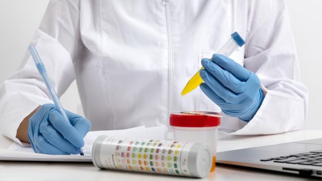 Hati-hati, Perubahan Warna Urine Bisa Jadi Tanda Gejala ISK