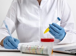 Hati-hati, Perubahan Warna Urine Bisa Jadi Tanda Gejala ISK