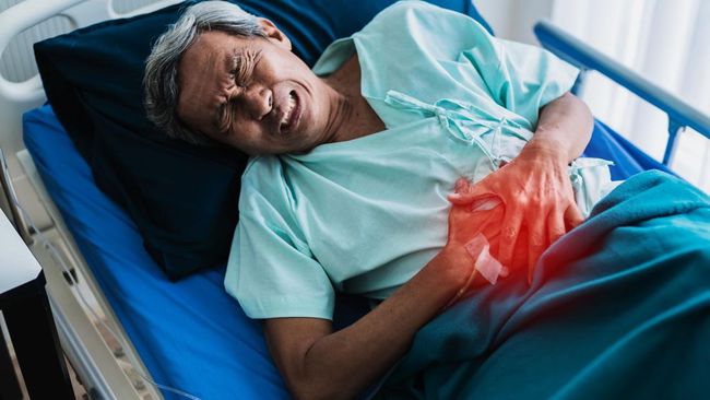 Apa Itu Kanker Kolorektal? Penyebab James Van Der Beek Dawsons Creek Meninggal Dunia