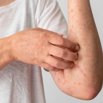 8 Dampak Pencemaran Sungai oleh Limbah Pestisida untuk Kesehatan dan Lingkungan