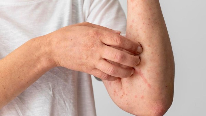 8 Dampak Pencemaran Sungai oleh Limbah Pestisida untuk Kesehatan dan Lingkungan