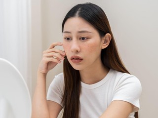 Kulit Mudah Merah? Kenali Pilihan Moisturizer Cica Sebelum Membeli
