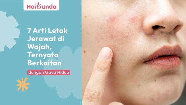 7 Arti Letak Jerawat di Wajah, Ternyata Berkaitan dengan Gaya Hidup