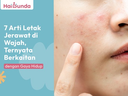7 Arti Letak Jerawat di Wajah, Ternyata Berkaitan dengan Gaya Hidup