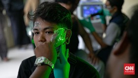 Apa Benar Laser bisa Langsung Menghapus Tato Permanen?