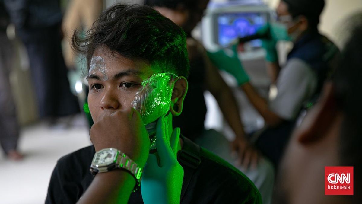 Apa Benar Laser bisa Langsung Menghapus Tato Permanen?