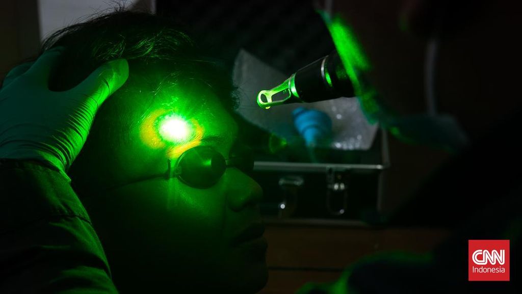 FOTO: Jalan Hijrah, Hapus Tato Gratis di Bulan Ramadan