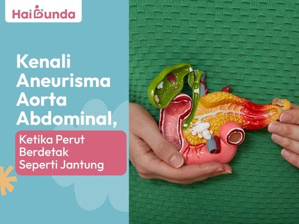 Kenali Aneurisma Aorta Abdominal, Ketika Perut Berdetak Seperti Jantung