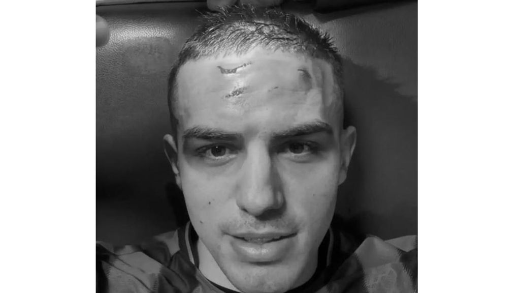 Krstovic Pamer Luka Mengerikan di Dahi Usai Diterjang Pul Sepatu Lawan