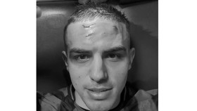 Krstovic Pamer Luka Mengerikan di Dahi Usai Diterjang Pul Sepatu Lawan