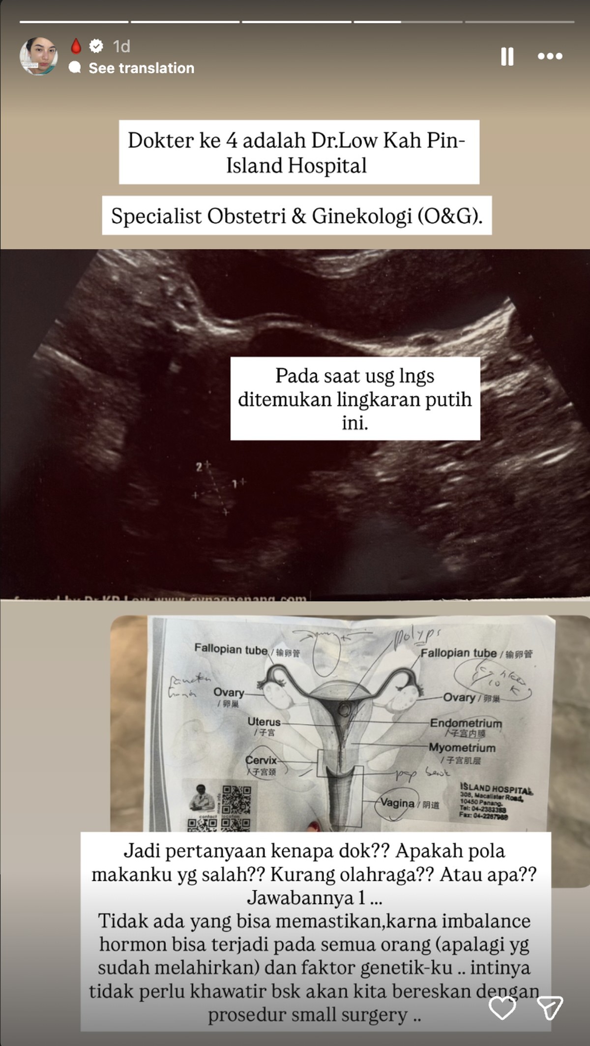 Chelsea Olivia ungkap kondisi kesehatan sebelum operasi&period;