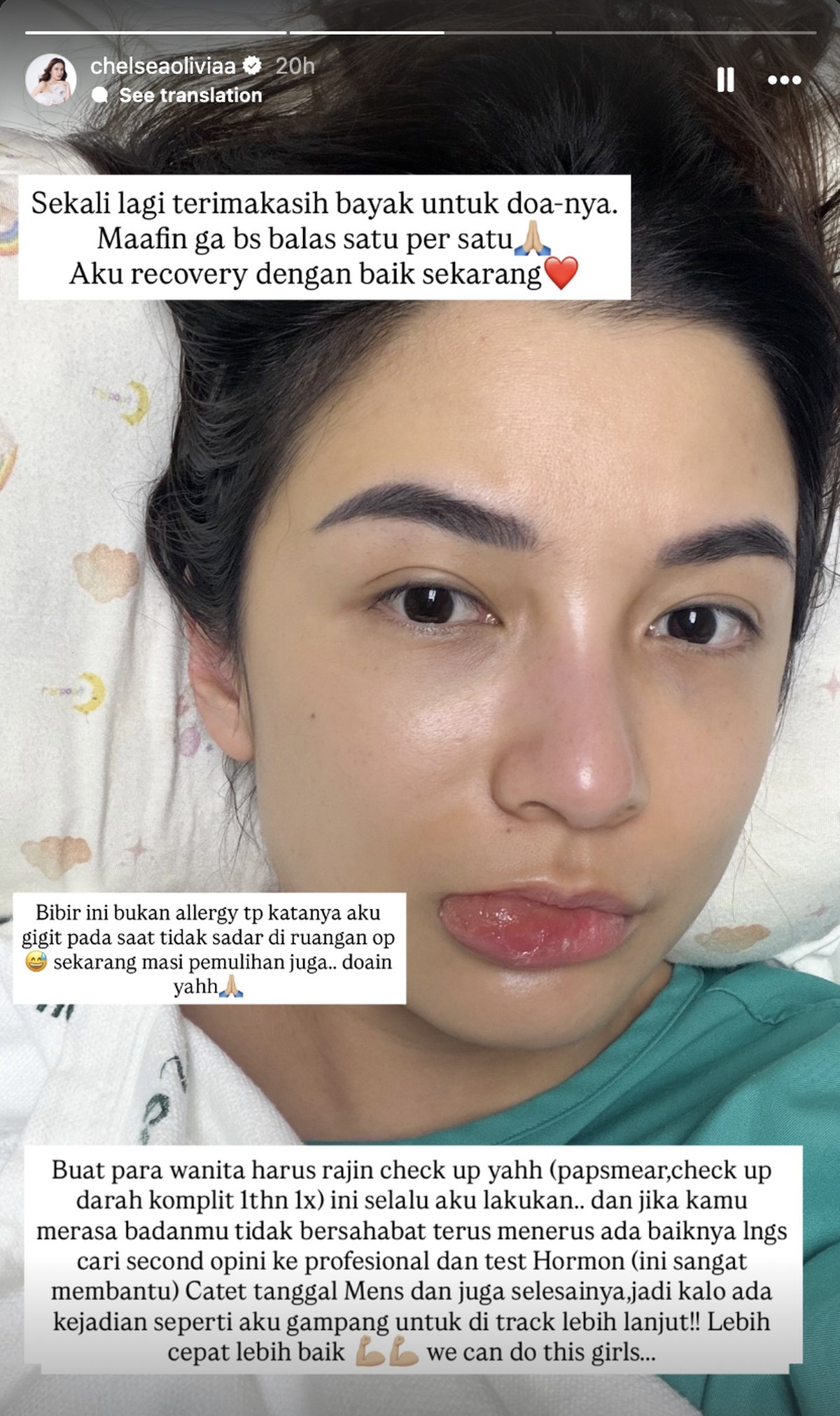 Chelsea Olivia ungkap kondisi kesehatan sebelum operasi&period;
