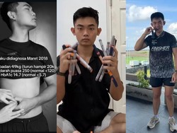 Viral Pria Usia 23 di Denpasar Idap Diabetes Tipe 1, Awalnya Keluhkan Gejala Ini
