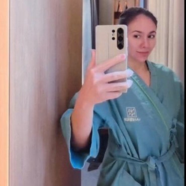 7 Potret Wulan Guritno Tampil Bareface Usai Oplas, Wajahnya Jadi Sorotan