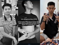 Viral Dialami Pria Usia 23 di Denpasar, Dokter Ungkap Pemicu Diabetes Tipe 1