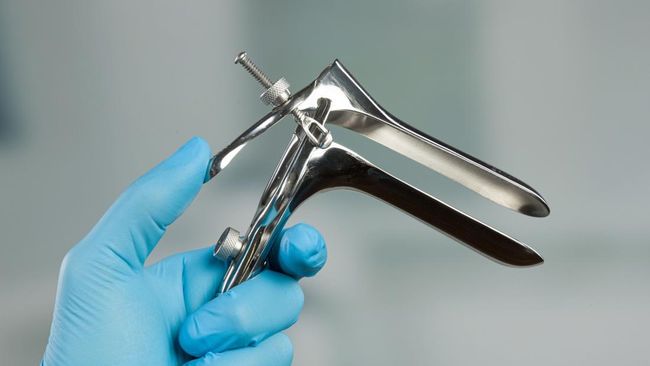 Mengenal Spekulum, Alat Medis untuk Pemeriksaan Vagina yang Mirip Cocor Bebek