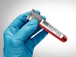 IDAI Beberkan Gejala Ruam Akibat Campak Vs Cacar Air, Kerap Dianggap Mirip