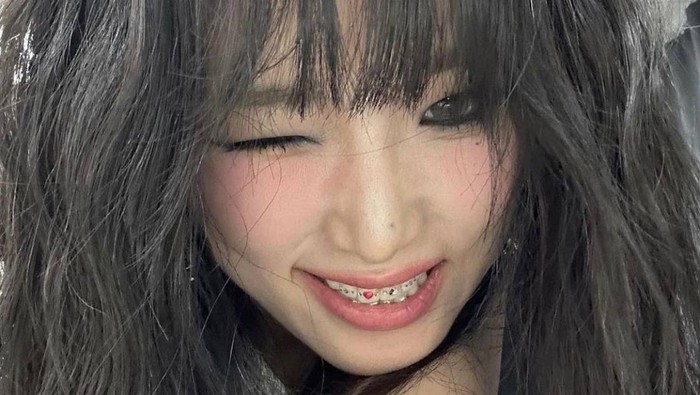 Yuk Kenalan dengan Tooth Gems, Hiasan Gigi yang Populer di Kalangan Gen Z