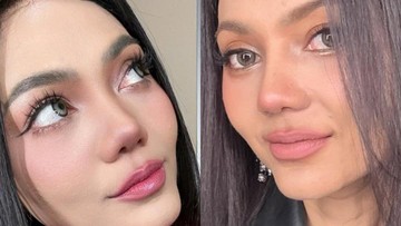 Cerita Rina Nose Alami Post-op Blues usai Oplas Hidung