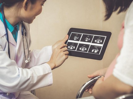 Ilmuwan Gunakan AI untuk Memprediksi Jenis Kelamin Bayi Sejak 3 Hari Kehamilan