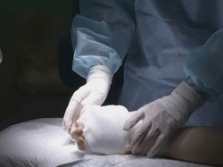 Video Rusia Sukses Lakukan Cangkok Tangan untuk Pertama Kalinya!