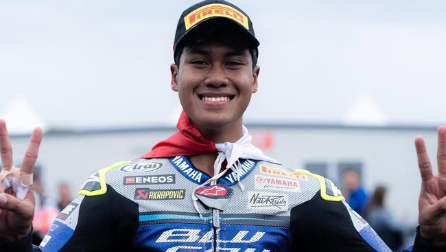 Pembalap WorldSSP 2026 asal Indonesia, Aldi Satya Mahendra disebut mengalami retak tulang tangan kiri usai mengalami tabrak lari di Jalan Magelang.