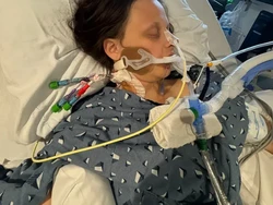 Ngeri! Usai Makan Ikan Fermentasi, Wanita Ini Nyaris Tewas