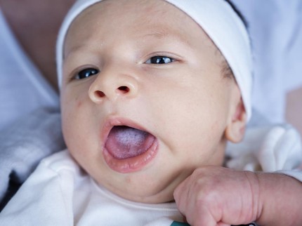 Jamur pada Mulut Bayi: Penyebab, Gejala, Cara Mencegah, & Mengobatinya