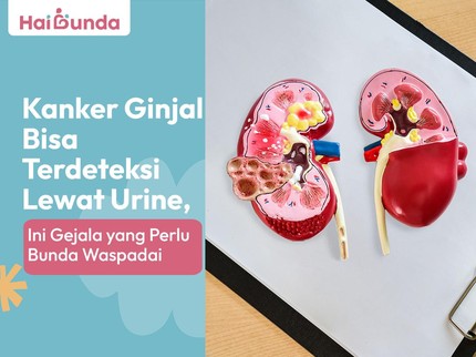 Kanker Ginjal Bisa Terdeteksi Lewat Urine, Ini Gejala yang Perlu Bunda Waspadai