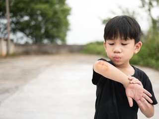 Atasi Luka Pakai Betadine Clear Antiseptic Spray, Cocok buat Semua Usia