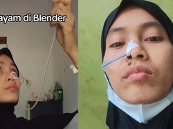 Viral Wanita Tasikmalaya Hanya Bisa Makan Lewat Selang, Idap Kondisi Langka Ini