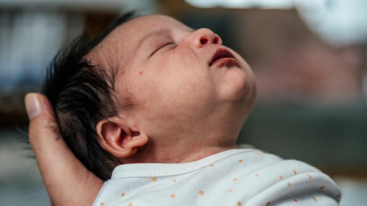 Anak Alami Breath Holding Spell? Tenang, Ini Cara Mengatasinya