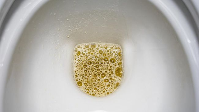 Air kencing berbusa sebenarnya normal. Namun jika sering terjadi, ini bisa jadi sinyal dari kondisi kesehatan tertentu.