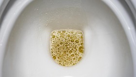 Air Kencing Berbusa: Apakah Normal dan Kapan Harus Cek ke Dokter?