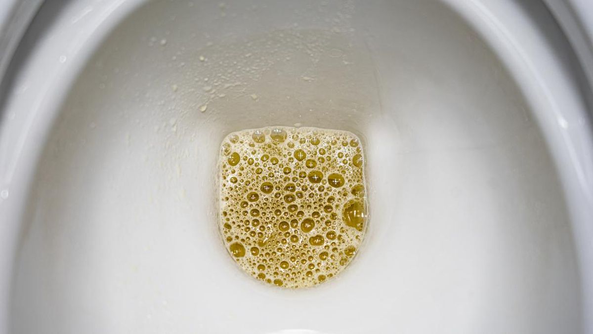 Air Kencing Berbusa: Apakah Normal Dan Kapan Harus Cek Ke Dokter?